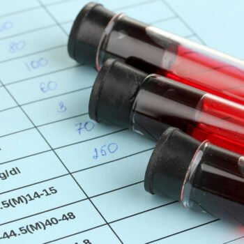 Blood in test tubes and results close up